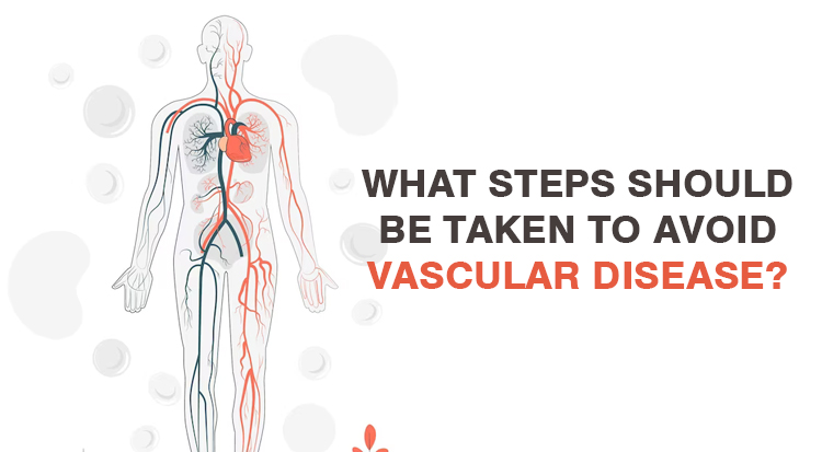 vascular-disease