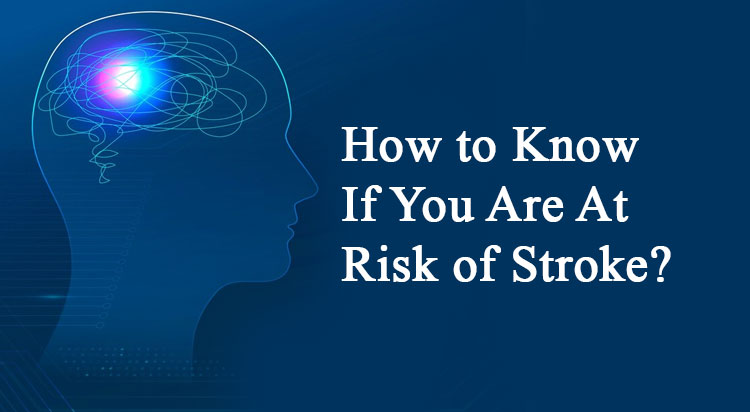 how-to-know-signs-of-stroke
