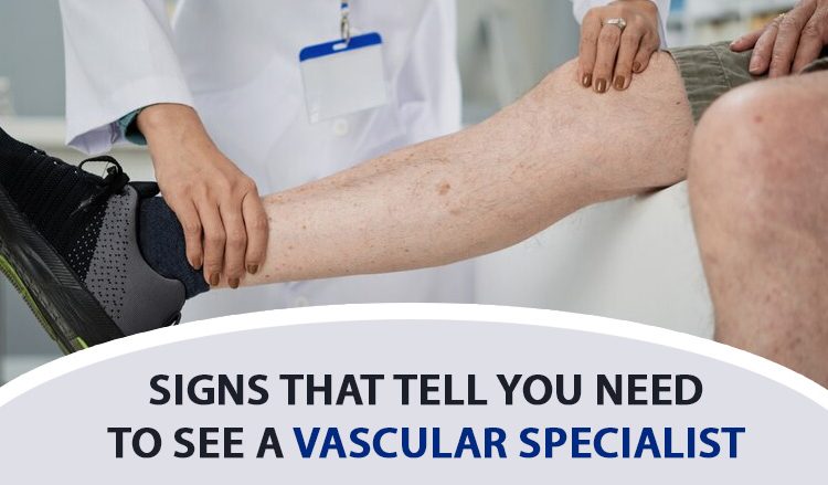 signs-you-need-to-see-a-vascular-specialist